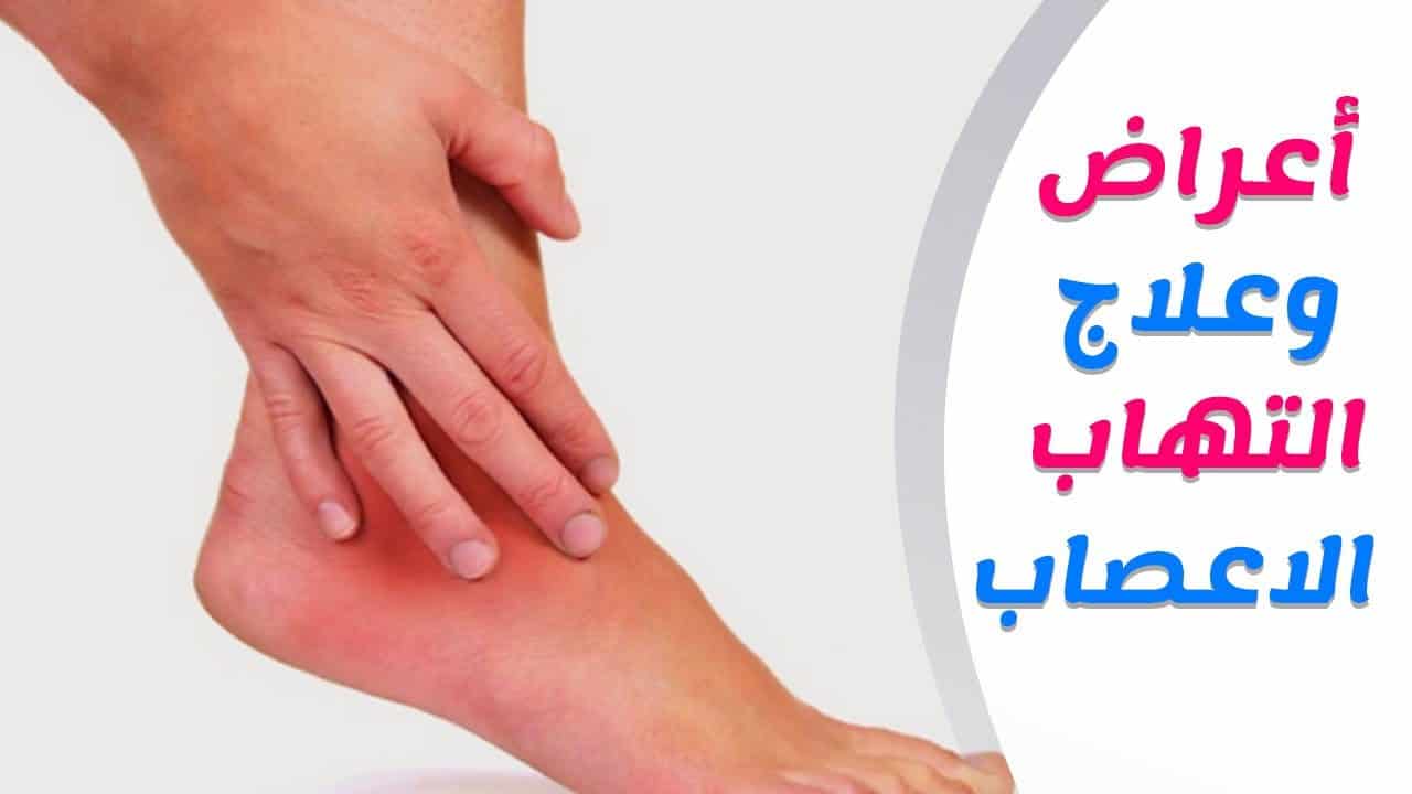 علاج الاعصاب , طرق اراحة الاعصاب