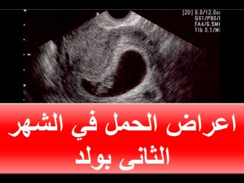 اعراض الحمل بولد , اهم مظاهر الحمل بولد