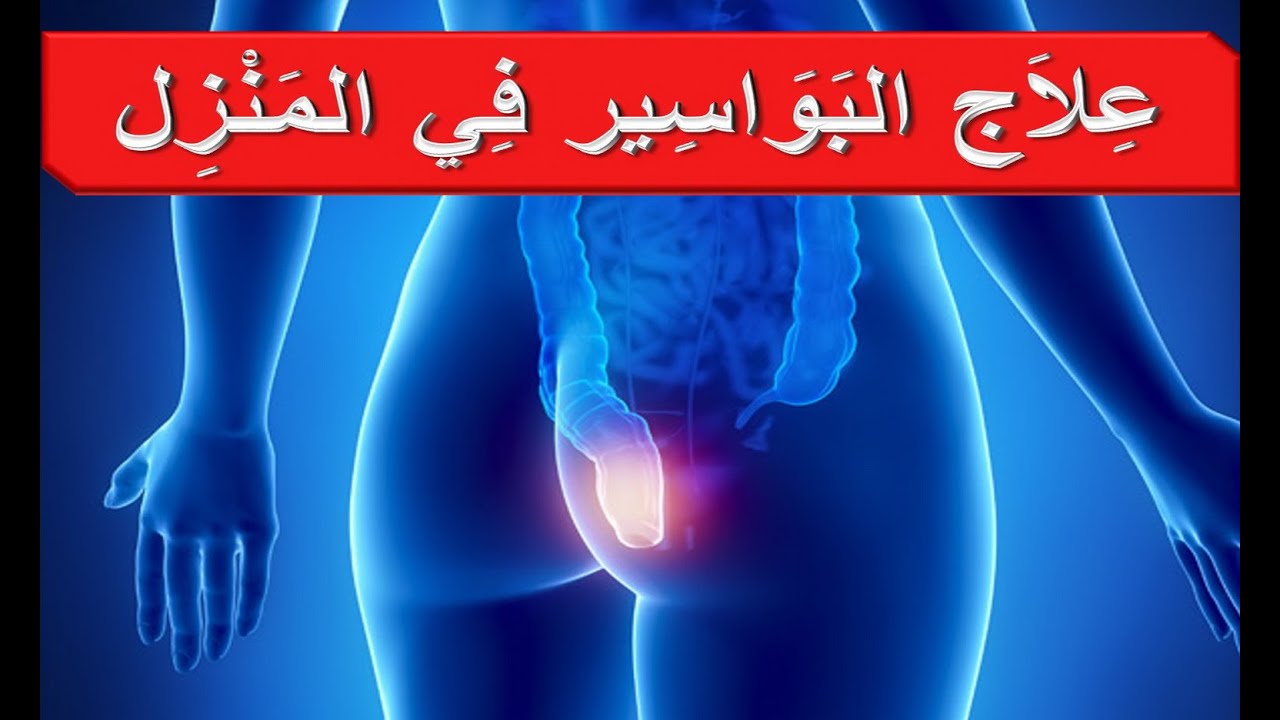 ما هي عملية البواسير - كل شئ عن البواسير 11869 2