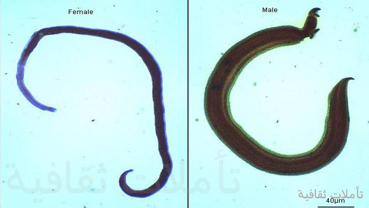 مرض البلهارسيا - معلومات تفيدك عن مرض بلهارسيا 259 8