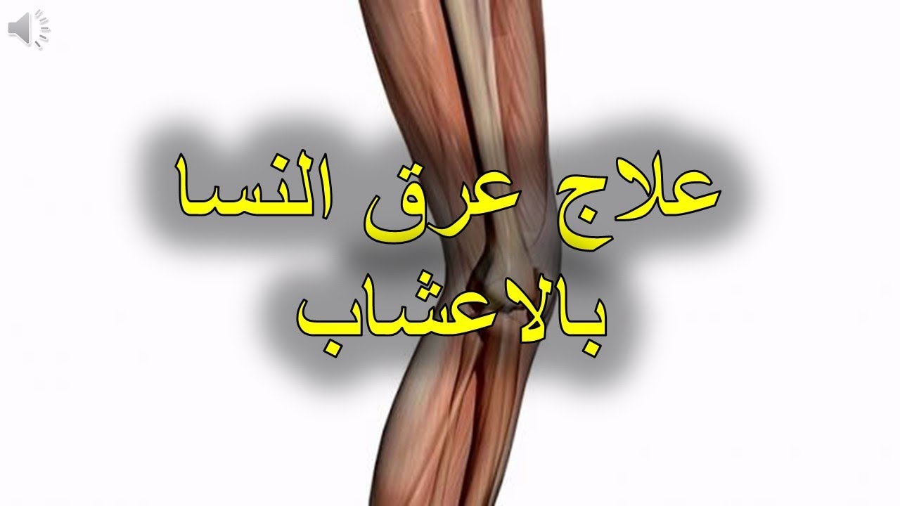 علاج عرق النسا بالاعشاب - كيفية علاج عرق النسا 5355 1