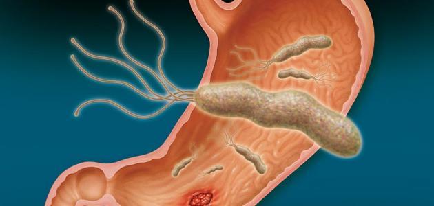 اعراض جرثومة المعدة - المعدة بيت الداء والدواء 3676 3