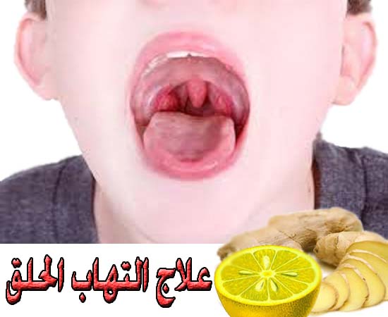 علاج وجع الحلق