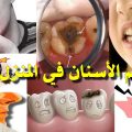 6002 3 علاج وجع الاسنان - افضل علاج لوجع الاسنان همهام رافع