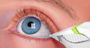12157 3 اعراض جفاف العين وعلاجه - جفاف العين الاسباب وطرق العلاج امال نوراني