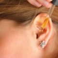 1648 3 علاج التهاب الاذن - اسرع طريقة فعالة للتخلص من التهابات الاذن الحان محظوظة